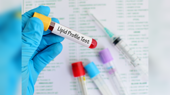 Doctor reviewing blood test results